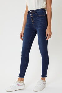 Victoria Button Fly Dark Wash Jeans